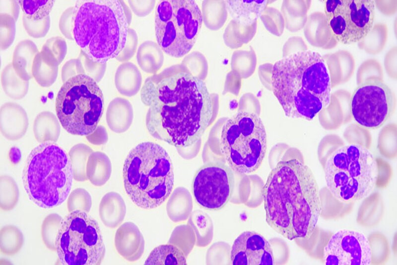 Illustration d'hématologie